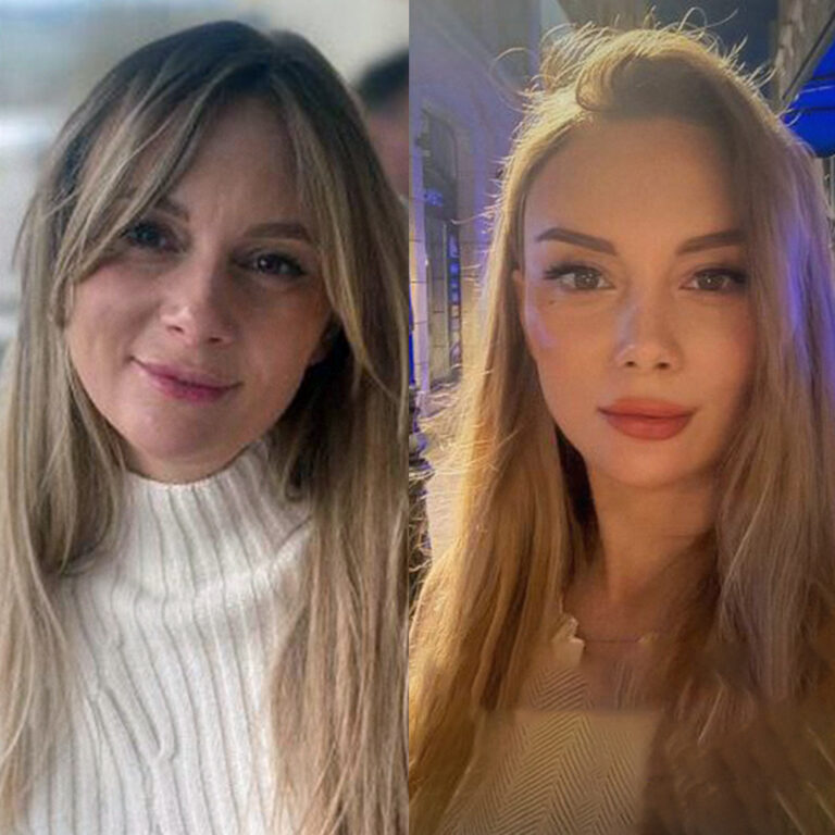 Facial lift